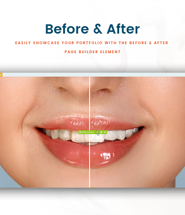 Clinio - Medical & Dental WordPress Theme Before And After